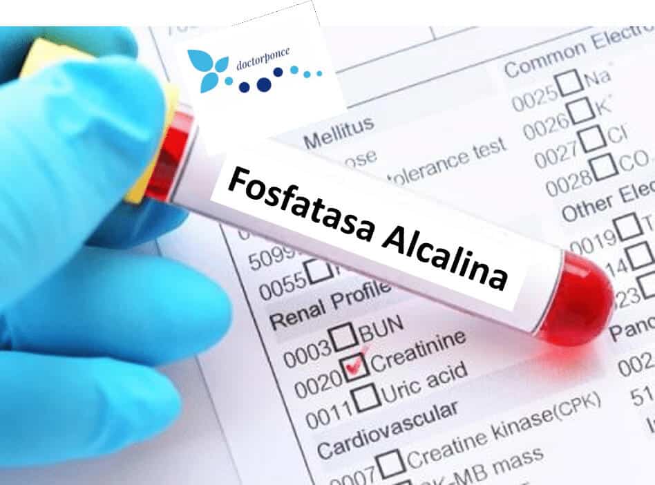 Tubo de muestra de sangre rotulado con "Fosfatasa Alcalina" sujeto por una mano con guante quirúrgico sobre un cuestionario analítico