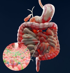 Cómo mejorar la microbiota intestinal